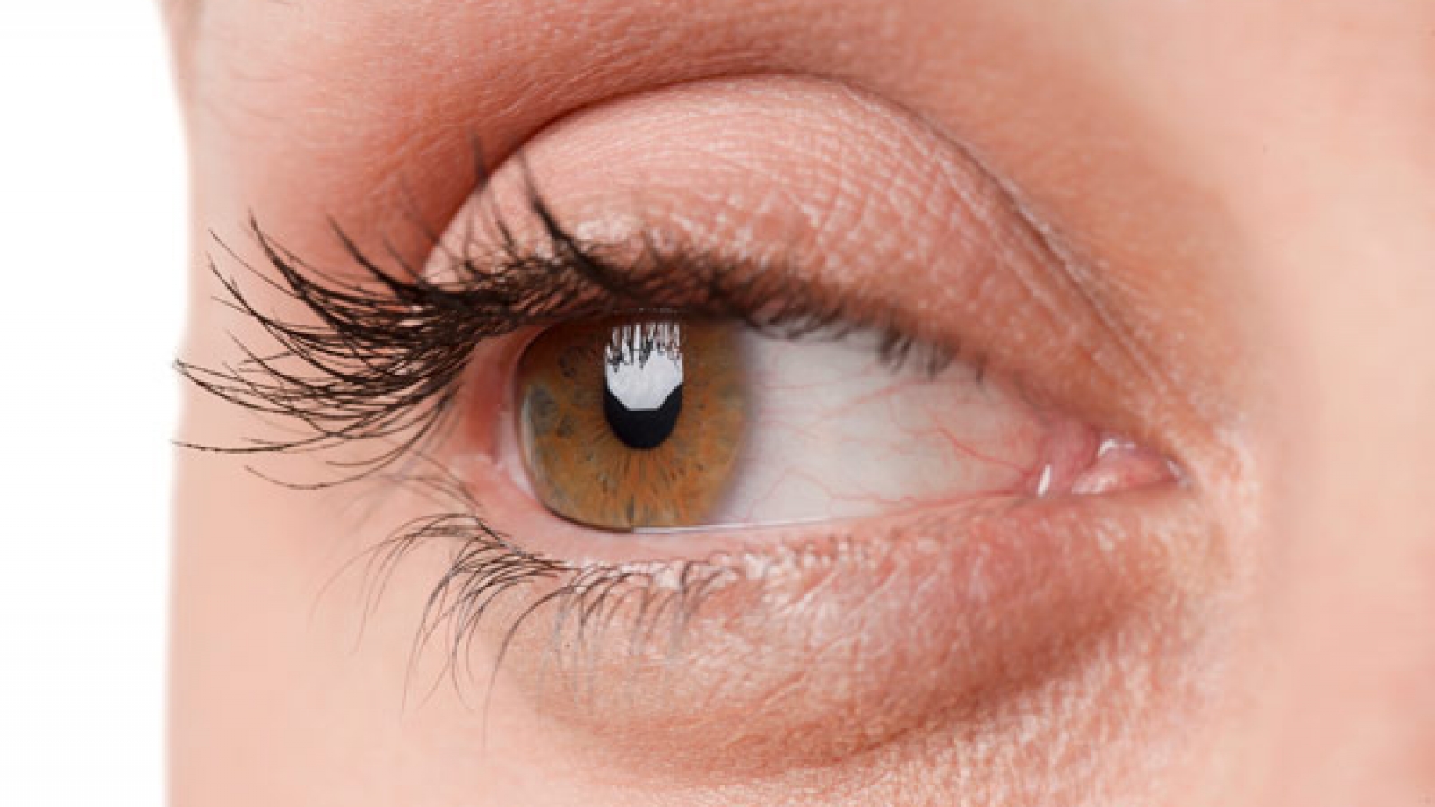 Glaukomska-obrada_mob