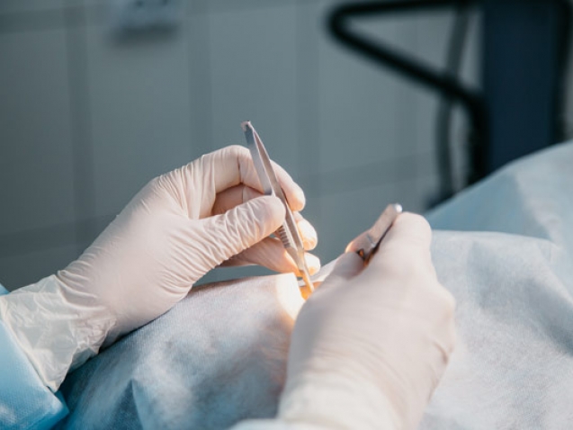 Home 47 Operacije-pterigija,-nevusa-i-melanoza-spojnice_mob